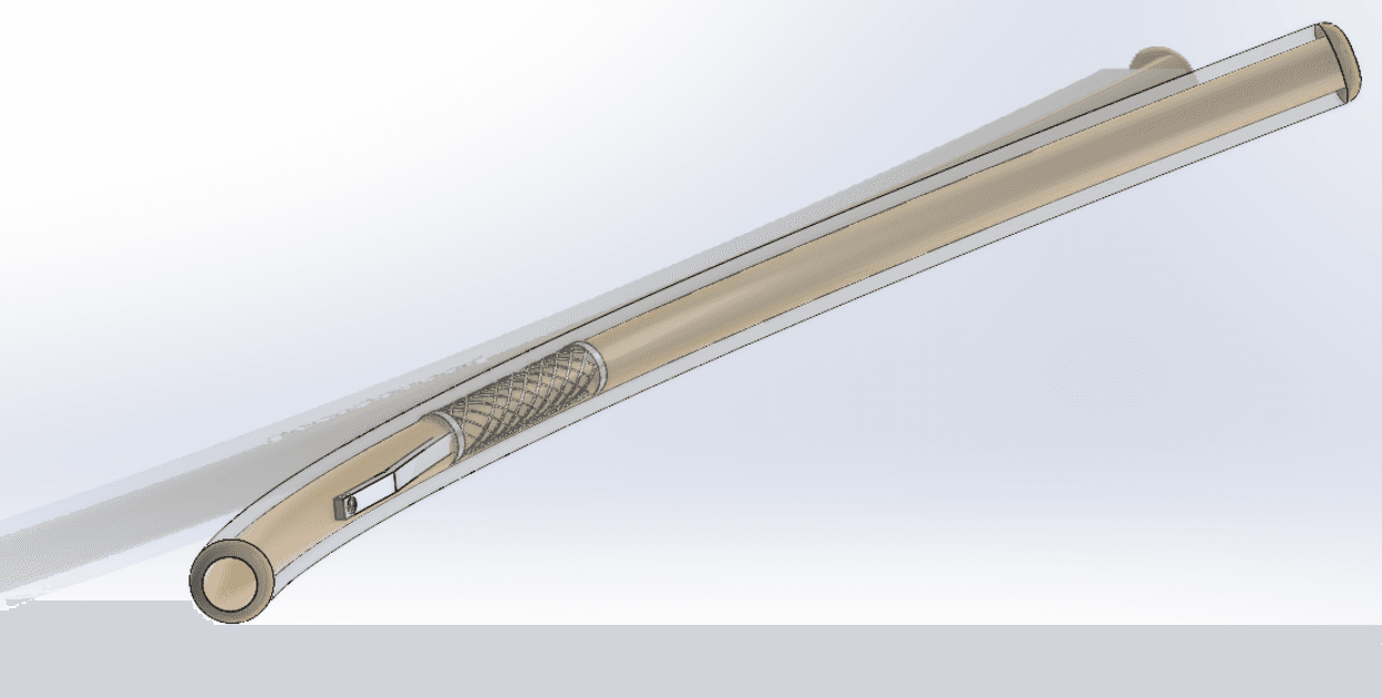 Intramedullary rib stent